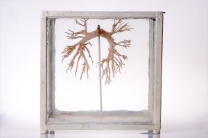 Model oskrzeli człowieka; 1. poł. XX w.; metal, szkło, tworzywo sztuczne; technika mieszana; MHM WUM/BN