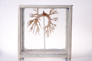 Model oskrzeli człowieka; 1. poł. XX w.; metal, szkło, tworzywo sztuczne; technika mieszana; MHM WUM/BN