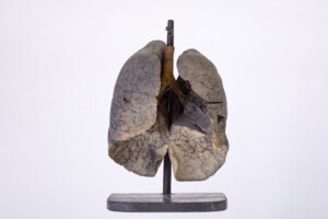 Model płuc osoby palącej wyroby tytoniowe; 2. poł. XX w.; styropian, drewno, metal; technika mieszana; MHM WUM/BN